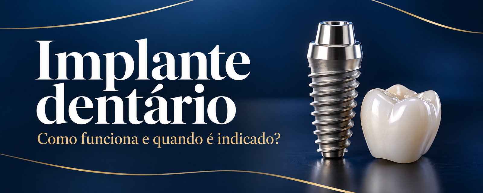 Implante dentário: como funciona e quando ele é indicado?